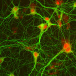 Neurons of rat's Hyppocampus