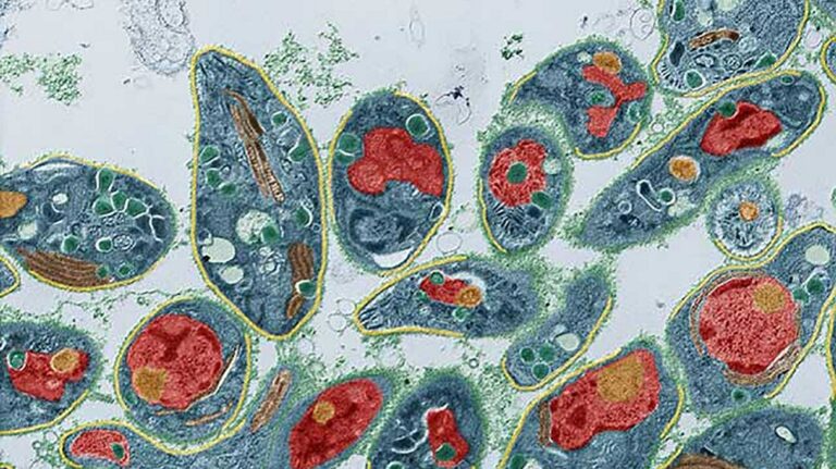 Engineering Toxoplasma gondii secretion systems for intracellular delivery of multiple large therapeutic proteins to neurons