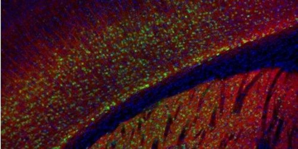 Simultaneous detection of membrane contact dynamics and associated Ca2+ signals by reversible chemogenetic reporters